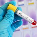 Addressing Disparities in HIV Mortality