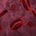 Ceftriaxone as Definitive OPAT for MSSA Bloodstream Infections