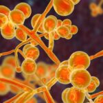 Study Reveals Transmission of Candida auris from Adults to Children in Maryland Hospital