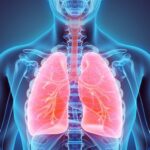 Pneumonia Diagnostic Shows Limited Utility