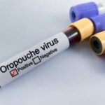 Oropouche Virus Disease and Its Impact on Public Health