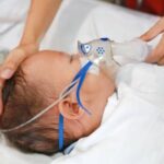 High Burden of RSV in Infants