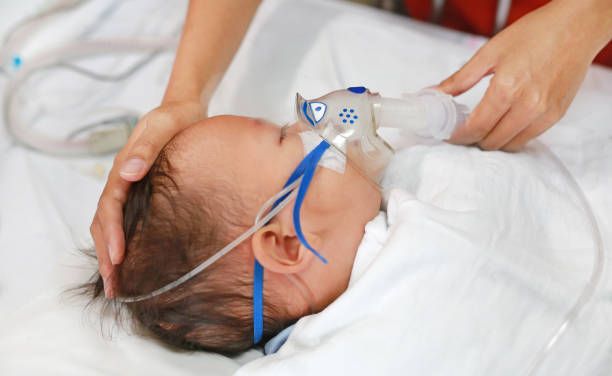 High Burden of RSV in Infants