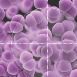 Daptomycin Resistance Among Enterococci Is a Growing Antimicrobial Resistance Threat