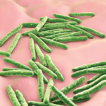 Tuberculosis Meningitis in an Immunocompetent Patient