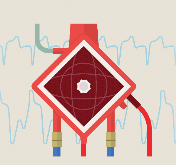 Infectious Diseases Provider Role in Extracorporeal Membrane Oxygenation Infections